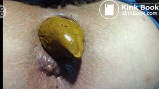 Blond Anus Hair Close Up Pooping Compilation