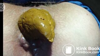 Blond Anus Hair Close Up Pooping Compilation