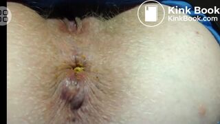 Blond Anus Hair Close Up Pooping Compilation