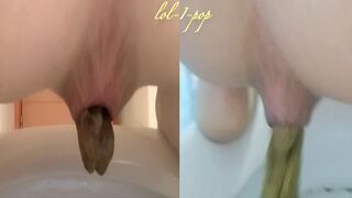 Amazing Distended Assholes ! - video 4