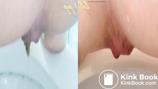 Amazing Distended Assholes ! - video 4