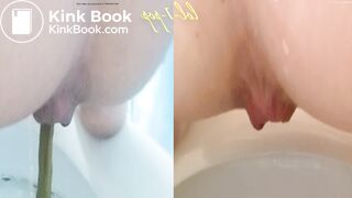 Amazing Distended Assholes ! - video 4