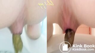 Amazing Distended Assholes ! - video 4