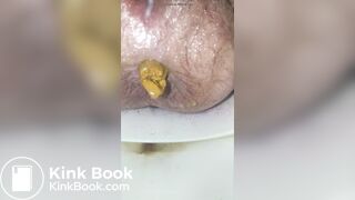 Huge logs after holding it for 2 days