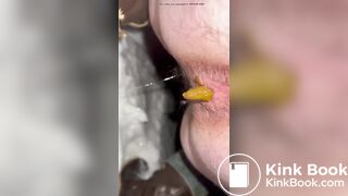 Dirty hairy ass slut shitting and pissing on the snow