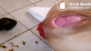 Shitting with her prolapsing rosebud after anal fisti
