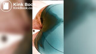 Diarrhea Accident comp