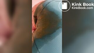 Diarrhea Accident comp