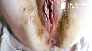 Vagina poo..