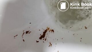 TFB - Beg For More Dose of My Shit