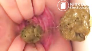 Prolapse scat - video 10