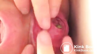 Prolapse scat - video 10