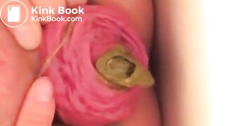 Prolapse scat - video 10