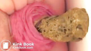 Prolapse scat - video 10