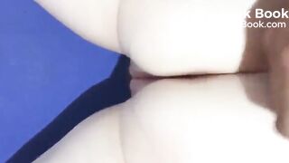 Cummies on her poo..