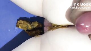 Cummies on her poo..