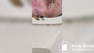 Super tiny hard shit