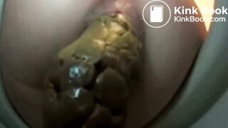 Close up of a woman pooping - video 17