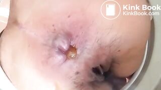 Close up of a woman pooping