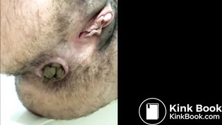 Very Hairy Lady Poop and Fart