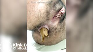 Very Hairy Lady Poop and Fart