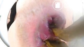 Close up of a woman pooping - video 14