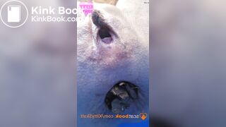 Dixie POV massive shits