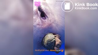 Dixie POV massive shits