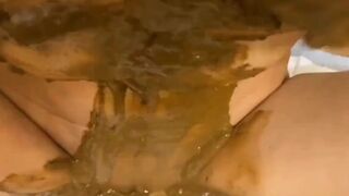 ❤️DIARRHEA SMEAR❤️