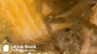 ❤️DIARRHEA SMEAR❤️