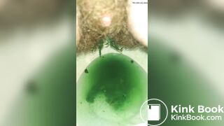 Full Of Christmas Cheer (Explosive Diarrhea)