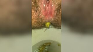 Shitting Like An Uncorked Champagne Bottle