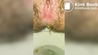 Shitting Like An Uncorked Champagne Bottle