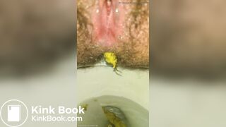 Shitting Like An Uncorked Champagne Bottle