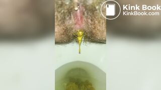 Dripping Shit From My Hairy Trans Ass