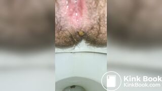 Little Balls Of Shit + Pissing Like A Broken Sprinkler