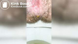 Little Balls Of Shit + Pissing Like A Broken Sprinkler