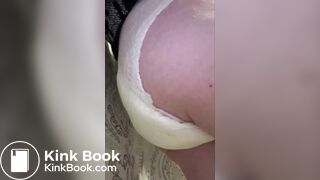 Diaper Diarrhea - video 4