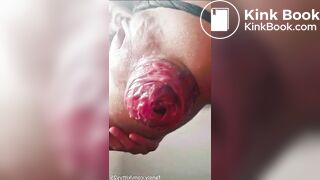 Prolapso Gigante audio de mexicana tragamierda