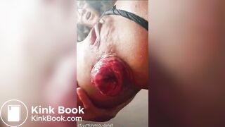 Prolapso Gigante audio de mexicana tragamierda