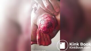 Prolapso Gigante audio de mexicana tragamierda