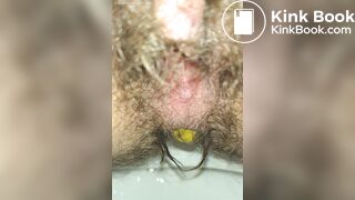 Emptying My Hairy Shitter