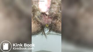 Emptying My Hairy Shitter