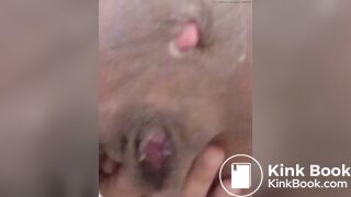 Black ebony brown eye got pink eye (end)