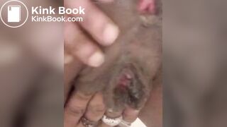 Black ebony brown eye got pink eye (end)