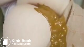 fat ass shitting diarrhea