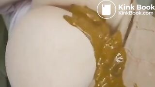 fat ass shitting diarrhea