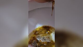 Girl Lactose Intolerance Diarrhea