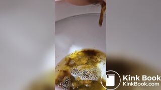 Girl Lactose Intolerance Diarrhea