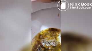 Girl Lactose Intolerance Diarrhea